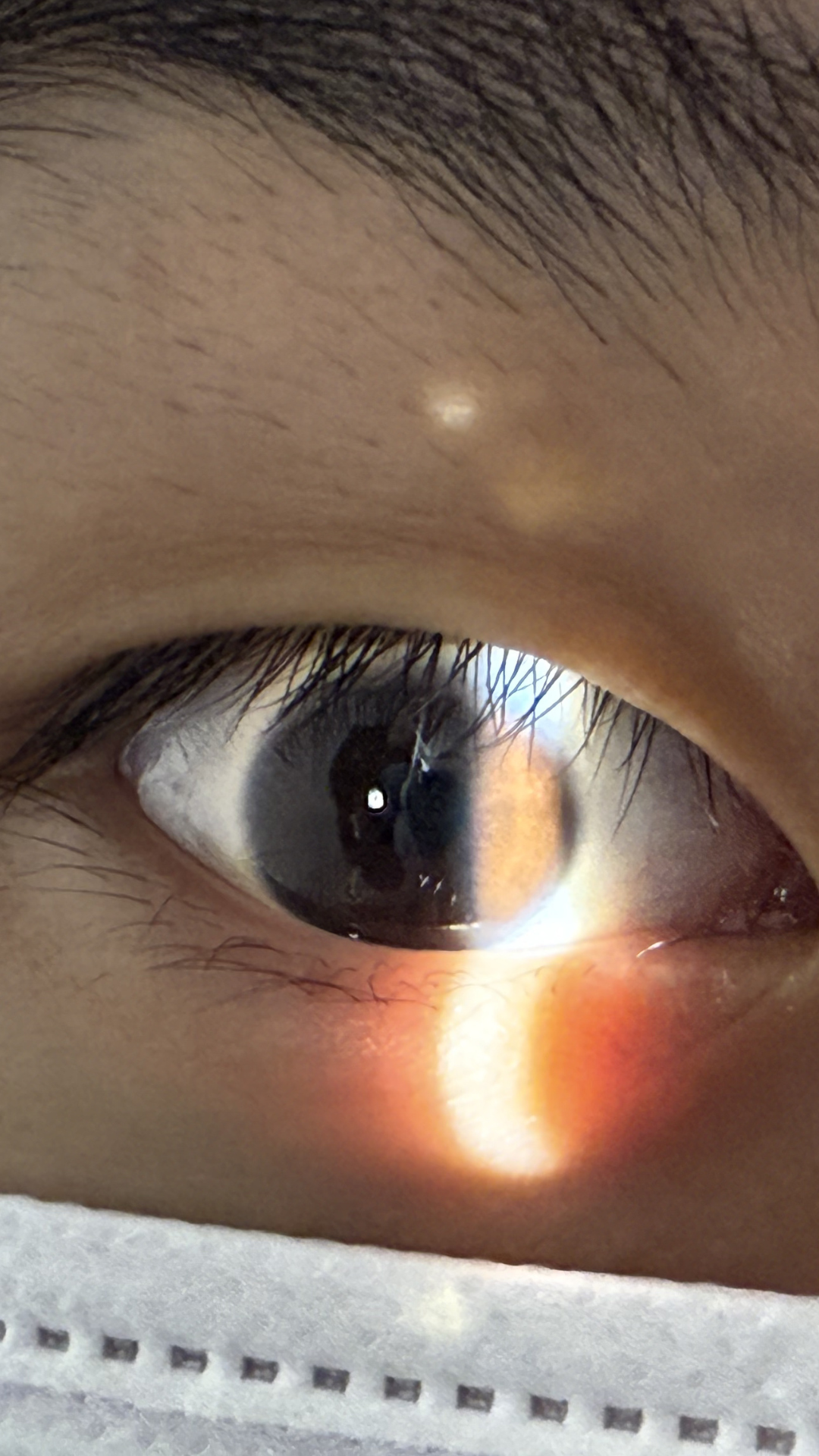 4-KJ-Optometrists-Optometrists-Checking-Front-Eye-Using-Slit-Lamp-Checking-For-Dry-Eyes-Health